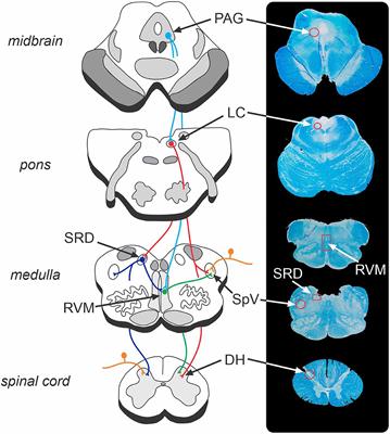 Brainstem Pain-Modulation Circuitry and Its Plasticity in Neuropathic Pain: Insights From Human Brain Imaging Investigations